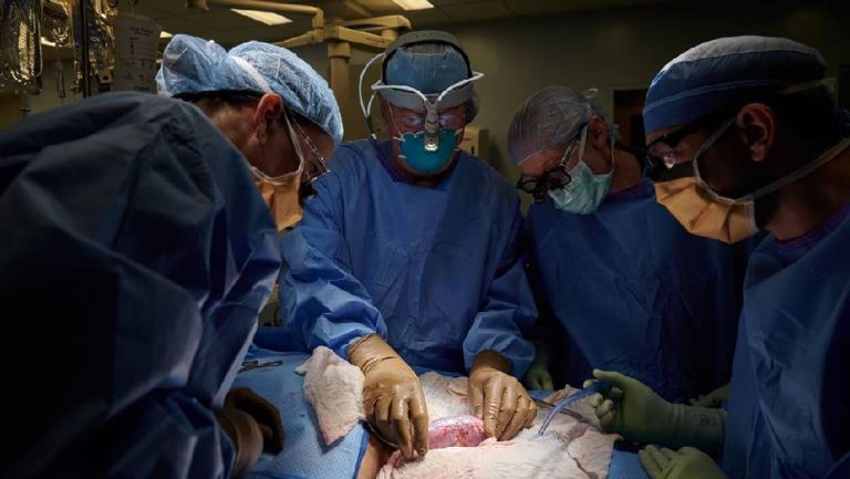 Muere el primer paciente con transferencia de riñón de cerdo