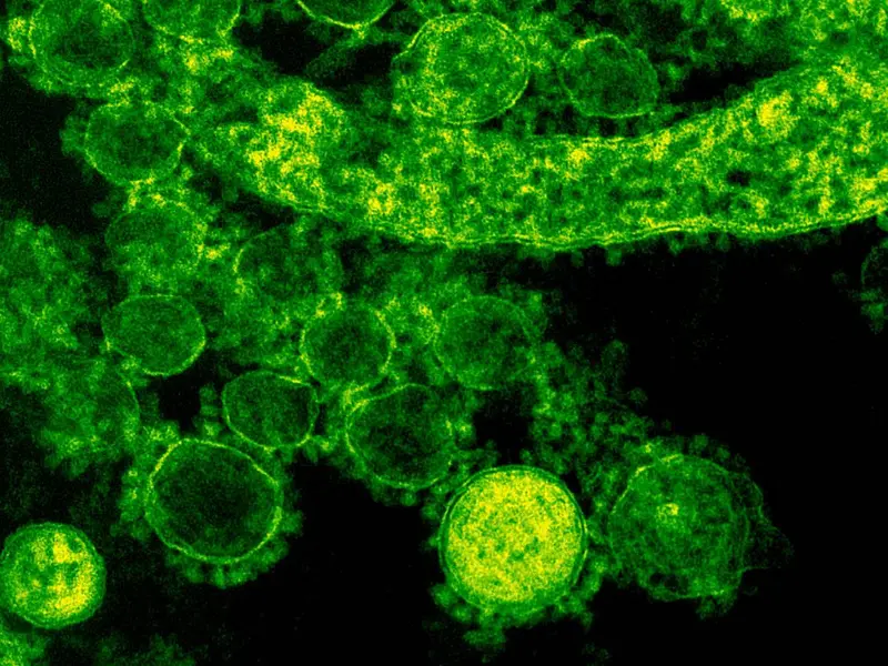 Bacteria carnívora pone en alerta a Japón; 977 casos este año