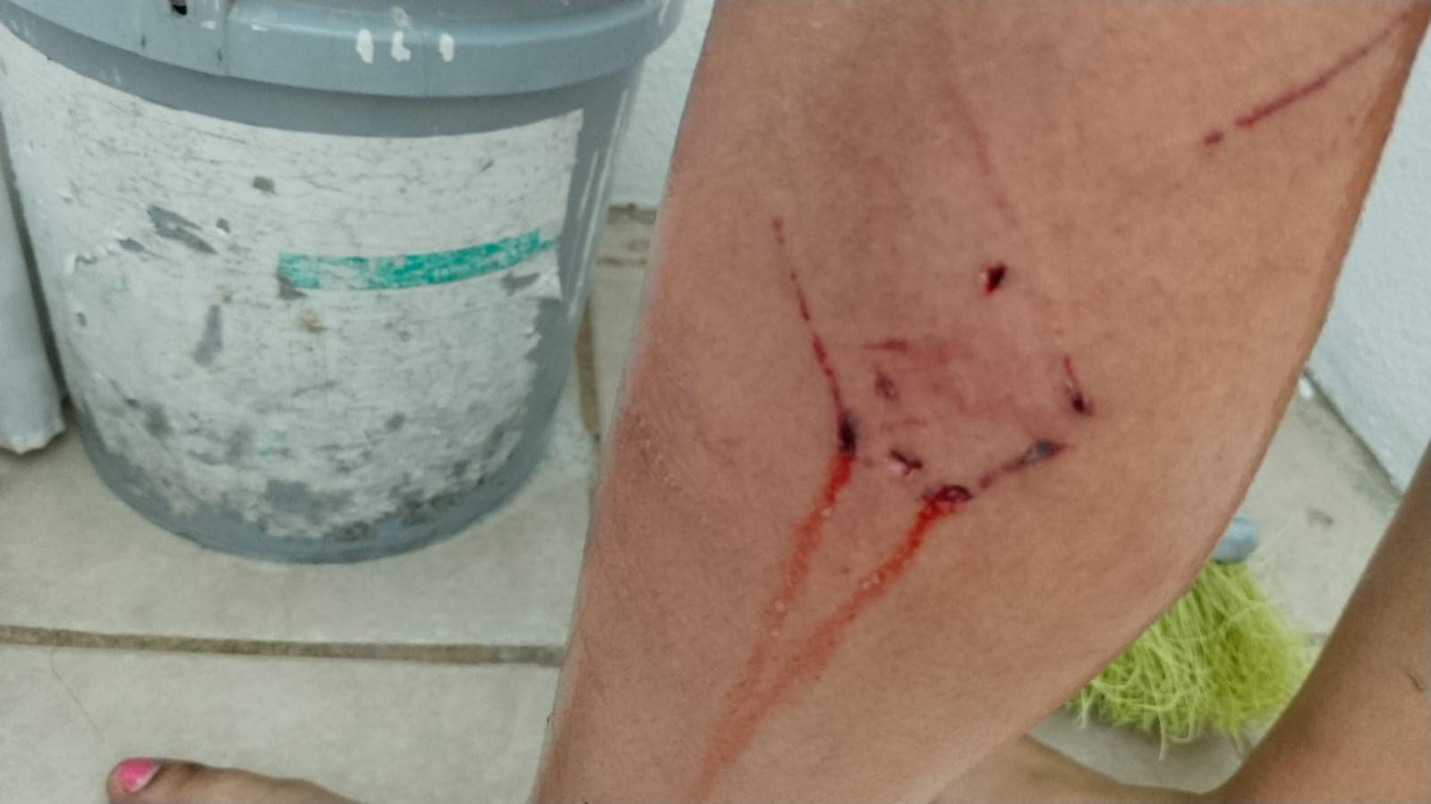Mujer es atacada por perros en la colonia Los Almendros