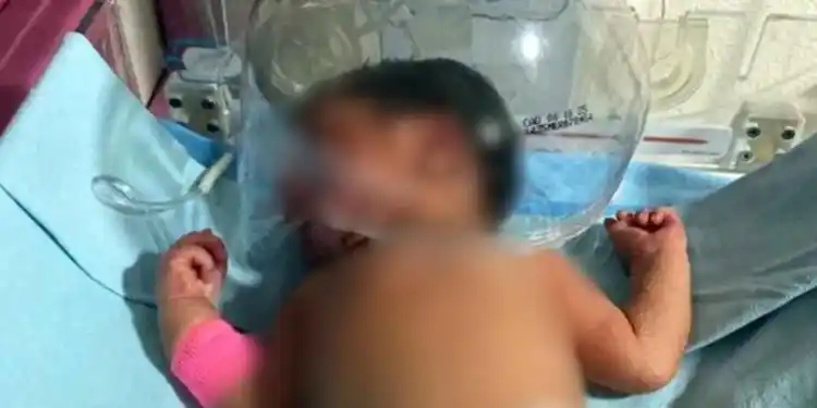 Improvisan con plástico para salvar a recién nacido en tabasco