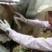 Personal médico atiende un caso de miasis humana por gusano barrenador en Tamaulipas.